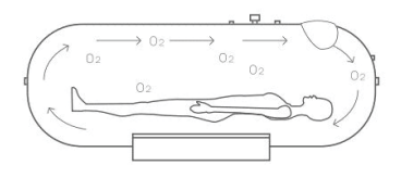 US Hyperbaric APOLLO 36″ Soft Hyperbaric Chamber — Spacious Interior (from $12,597)